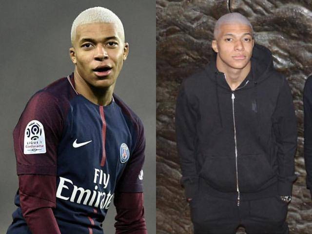 使防线收缩 使防线收缩